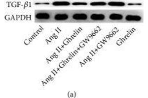 Western Blotting (WB) image for anti-Glyceraldehyde-3-Phosphate Dehydrogenase (GAPDH) (AA 1-335) antibody (ABIN3020538)