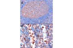 Immunohistochemistry (IHC) image for anti-Glyceraldehyde-3-Phosphate Dehydrogenase (GAPDH) (C-Term) antibody (ABIN185240)