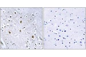 Immunohistochemistry analysis of paraffin-embedded human brain tissue, using IRS-1 (Ab-639) Antibody. (IRS1 Antikörper  (AA 605-654))