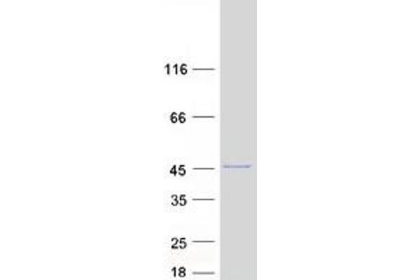 ARPC1A Protein (Myc-DYKDDDDK Tag)