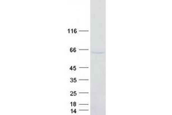 FOXQ1 Protein (Myc-DYKDDDDK Tag)