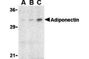 Western blot analysis of adiponectin in rat brain cell lysate with adiponectin antibody at (A) 1, (B) 2, and (C) 4 µg/mL. (ADIPOQ Antikörper  (N-Term))