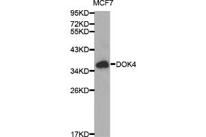 Western blot analysis of extracts of MCF-7 cells, using DOK4 antibody (ABIN5970056) at 1/1000 dilution. (DOK4 Antikörper)