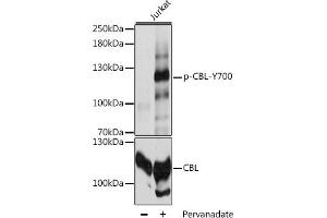 Western blot analysis of extracts of Jurkat cells, using Phospho-CBL-Y700 antibody (ABIN6135196, ABIN6136034, ABIN6136035 and ABIN6225680) at 1:2000 dilution or CBL antibody (ABIN6131302, ABIN6138002, ABIN6138004 and ABIN6213970). (CBL Antikörper  (pTyr700))