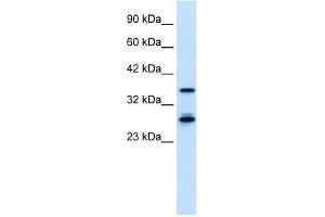 M96 antibody used at 0. (MTF2 Antikörper  (Middle Region))