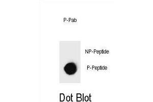 Dot blot analysis of Phospho-IKKB- Antibody Phospho-specific Pab (ABIN1539772 and ABIN2839876) on nitrocellulose membrane. (IKBKB Antikörper  (pSer697))