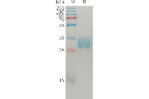 Human SL Protein, His Tag on SDS-PAGE under reducing condition. (SLAMF8 Protein (AA 23-233) (His tag))