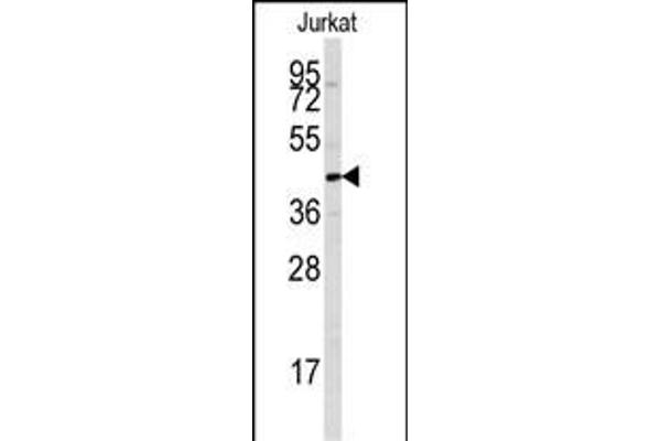 PTPN7 Antikörper  (AA 22-51)