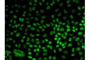 Immunofluorescence analysis of U20S cell using BUB3 antibody. (BUB3 Antikörper)
