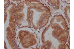 Immunohistochemistry (IHC) image for anti-Lysyl Oxidase-Like 2 (LOXL2) antibody (ABIN7127602)