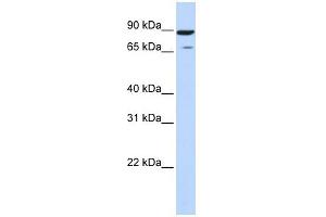 HIPK4 antibody used at 1 ug/ml to detect target protein. (HIPK4 Antikörper  (Middle Region))