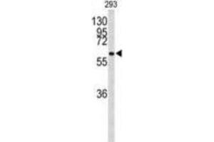 Western Blotting (WB) image for anti-Parafibromin (CDC73) antibody (ABIN3004068) (HRPT2 Antikörper)