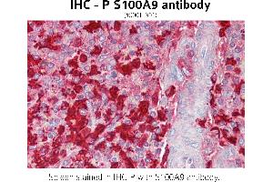 Image no. 1 for anti-S100 Calcium Binding Protein A9 (S100A9) (C-Term) antibody (ABIN1515088) (S100A9 Antikörper  (C-Term))