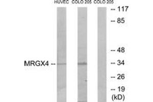 Western blot analysis of extracts from HuvEc/COLO cells, using MRGX4 Antibody. (MRGPRX4 Antikörper  (AA 271-320))