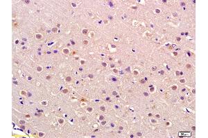 Formalin-fixed and paraffin embedded rat brain labeled with Anti-P105 RB Polyclonal Antibody, Unconjugated (ABIN680548) at 1:200 followed by conjugation to the secondary antibody and DAB staining (Retinoblastoma 1 Antikörper  (AA 51-150))