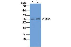 Figure. (GSTM1 Antikörper  (AA 1-218))