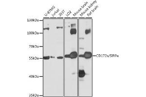 Western blot analysis of extracts of various cell lines, using CD172a/SIRPα antibody (ABIN6130058, ABIN6147780, ABIN6147781 and ABIN6224854) at 1:1000 dilution. (SIRPA Antikörper  (AA 395-504))