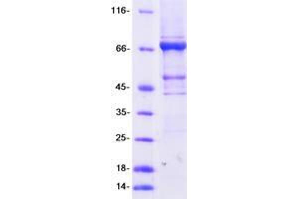 TRMT2A Protein (Transcript Variant 1) (Myc-DYKDDDDK Tag)