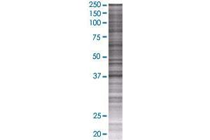 NKX2-1 transfected lysate. (TITF1 293T Cell Transient Overexpression Lysate(Denatured))