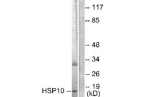 Western blot analysis of extracts from NIH/3T3 cells, using HSP10 antibody (#C0230). (HSPE1 Antikörper)