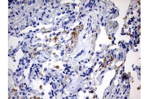 Immunohistochemistry (IHC) image for anti-ATP-Binding Cassette, Sub-Family D (Ald), Member 1 (ABCD1) (AA 508-745) antibody (ABIN2715621) (ABCD1 Antikörper  (AA 508-745))