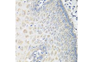 Immunohistochemistry of paraffin-embedded human esophagus using OXCT1 antibody (ABIN5974499) at dilution of 1/100 (40x lens). (OXCT1 Antikörper)