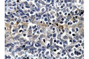 Immunohistochemistry analyzes of VASP antibody in paraffin-embedded human tonsil tissue. (VASP Antikörper)