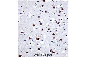 Immunohistochemistry (Paraffin-embedded Sections) (IHC (p)) image for anti-Proto-oncogene tyrosine-protein kinase Src (Src) (AA 24-52), (N-Term) antibody (ABIN1881833)