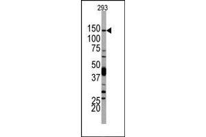 Image no. 1 for anti-Phosphoinositide-3-Kinase, Catalytic, delta Polypeptide (PIK3CD) (N-Term) antibody (ABIN360449) (PIK3CD Antikörper  (N-Term))