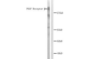 Western blot analysis of extracts from NIH/3T3 cells. (PDGFRB Antikörper)