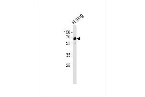 Western blot analysis of lysate from human lung tissue lysate,using SLC24A4 Antibody, was diluted at 1:1000. (SLC24A4 Antikörper)