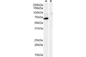 Image no. 1 for anti-Monoamine Oxidase A (MAOA) (Internal Region) antibody (ABIN374605) (Monoamine Oxidase A Antikörper  (Internal Region))