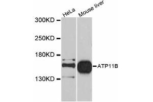Western blot analysis of extracts of various cell lines, using ATP11B antibody (ABIN5997278) at 1/1000 dilution. (ATP11B Antikörper)