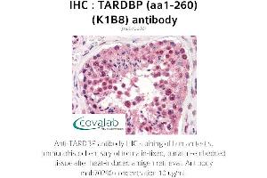 Image no. 2 for anti-TAR DNA Binding Protein (TARDBP) (AA 1-260) antibody (ABIN1723216) (TARDBP Antikörper  (AA 1-260))