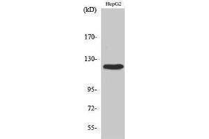 Western Blotting (WB) image for anti-PTK2 Protein tyrosine Kinase 2 (PTK2) (Thr433) antibody (ABIN3184579) (FAK Antikörper  (Thr433))