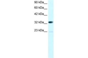 Western Blotting (WB) image for anti-Chromobox Homolog 4 (CBX4) antibody (ABIN2460142) (CBX4 Antikörper)