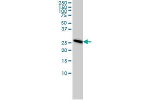 Western Blotting (WB) image for anti-Proteasome Subunit alpha  7 (PSMA7) (AA 1-248) antibody (ABIN562474)