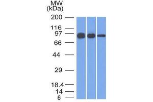 Western Blot of A431, A549 and MCF-7 cell lysates using Catenin, beta Mouse Monoclonal Antibody (12F7) (CTNNB1 Antikörper  (N-Term))