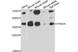 Western blot analysis of extracts of various cell lines, using EPM2A antibody. (EPM2A Antikörper)