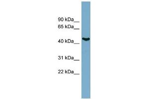 WB Suggested Anti-IRX6 Antibody Titration:  0. (IRX6 Antikörper  (N-Term))