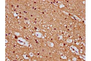 IHC image of ABIN7168823 diluted at 1:100 and staining in paraffin-embedded human brain tissue performed on a Leica BondTM system. (SEMA6B Antikörper  (AA 756-888))