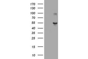 Image no. 1 for anti-TAP Binding Protein-Like (TAPBPL) antibody (ABIN1501305) (TAPBPL Antikörper)