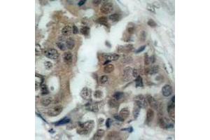 Image no. 2 for anti-BCL2-Associated Agonist of Cell Death (BAD) (pSer136), (pSer99) antibody (ABIN317969) (BAD Antikörper  (pSer99, pSer136))