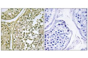 Immunohistochemistry analysis of paraffin-embedded human testis tissue, using CKI- alpha 1/L antibody. (CSNK1A1L Antikörper  (Internal Region))