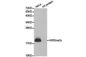 Western Blotting (WB) image for anti-Histone 3 (H3) (H3R2me2s) antibody (ABIN1873009) (Histone 3 Antikörper  (H3R2me2s))