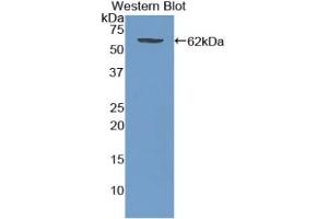 Western Blotting (WB) image for Wingless-Type MMTV Integration Site Family, Member 5A (WNT5A) ELISA Kit (ABIN6574332)