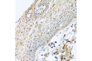 Immunohistochemistry of paraffin-embedded human esophagus using NDUFA2 antibody (ABIN5974497) at dilution of 1/100 (40x lens). (NDUFA2 Antikörper)