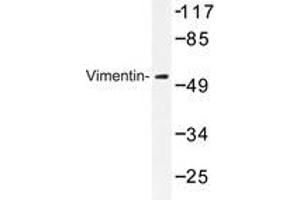 Western blot analysis of Vimentin antibody in extracts from 293 cells. (Vimentin Antikörper)