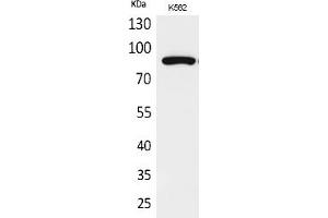 Western Blot analysis of K562 cells using Acetyl-HSP 90 (K292/284) Polyclonal Antibody. (HSP90 Antikörper  (acLys284, acLys292))