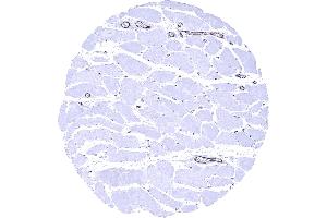 Skeletal muscle In skeletal muscle endothelial vWF immunostaining is strong in postcapillary venules and somewhat weaker in capillaries (Rekombinanter VWF Antikörper  (AA 1815-1939))